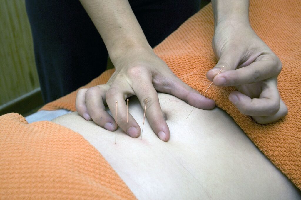 Acupuncture procedure